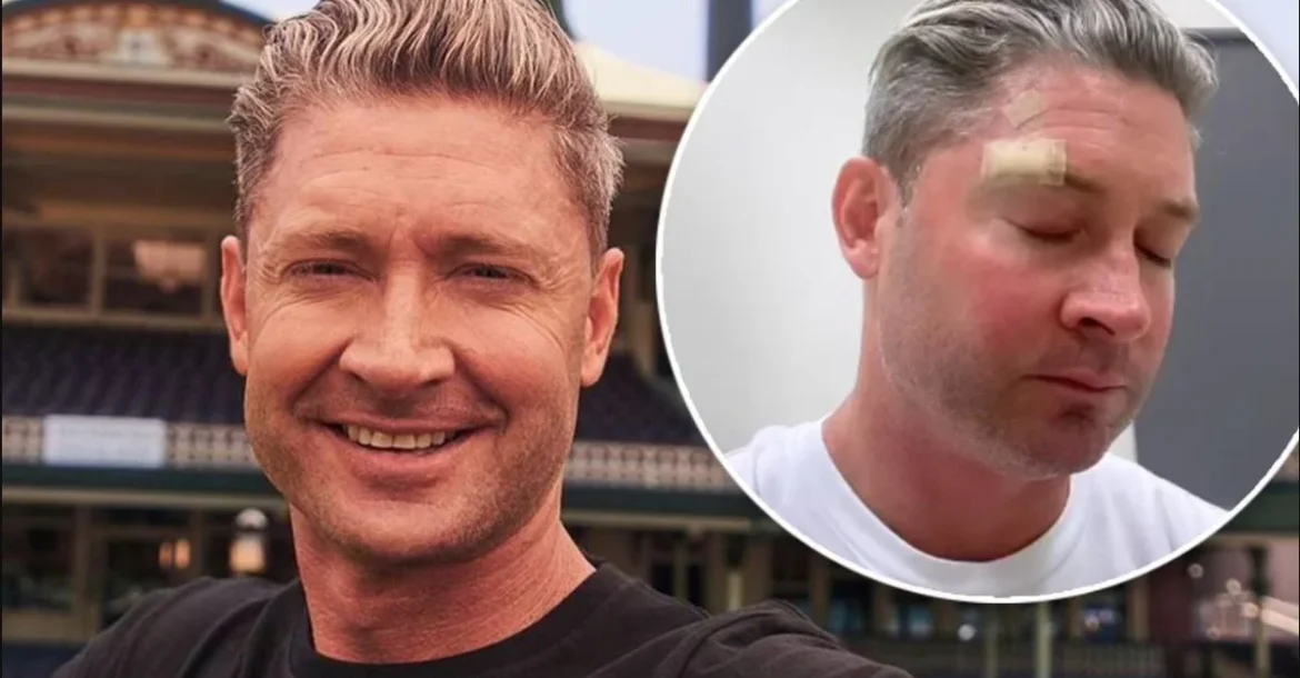 Michael Clarke diagnosed with skin cancer