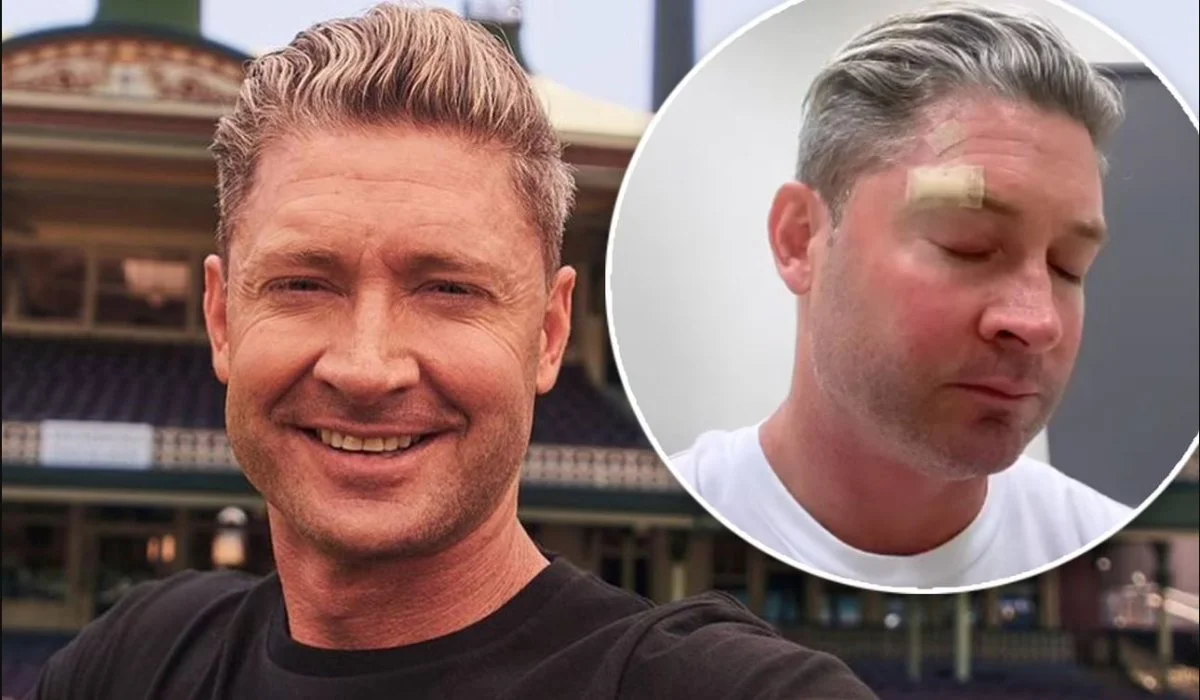 Michael Clarke diagnosed with skin cancer